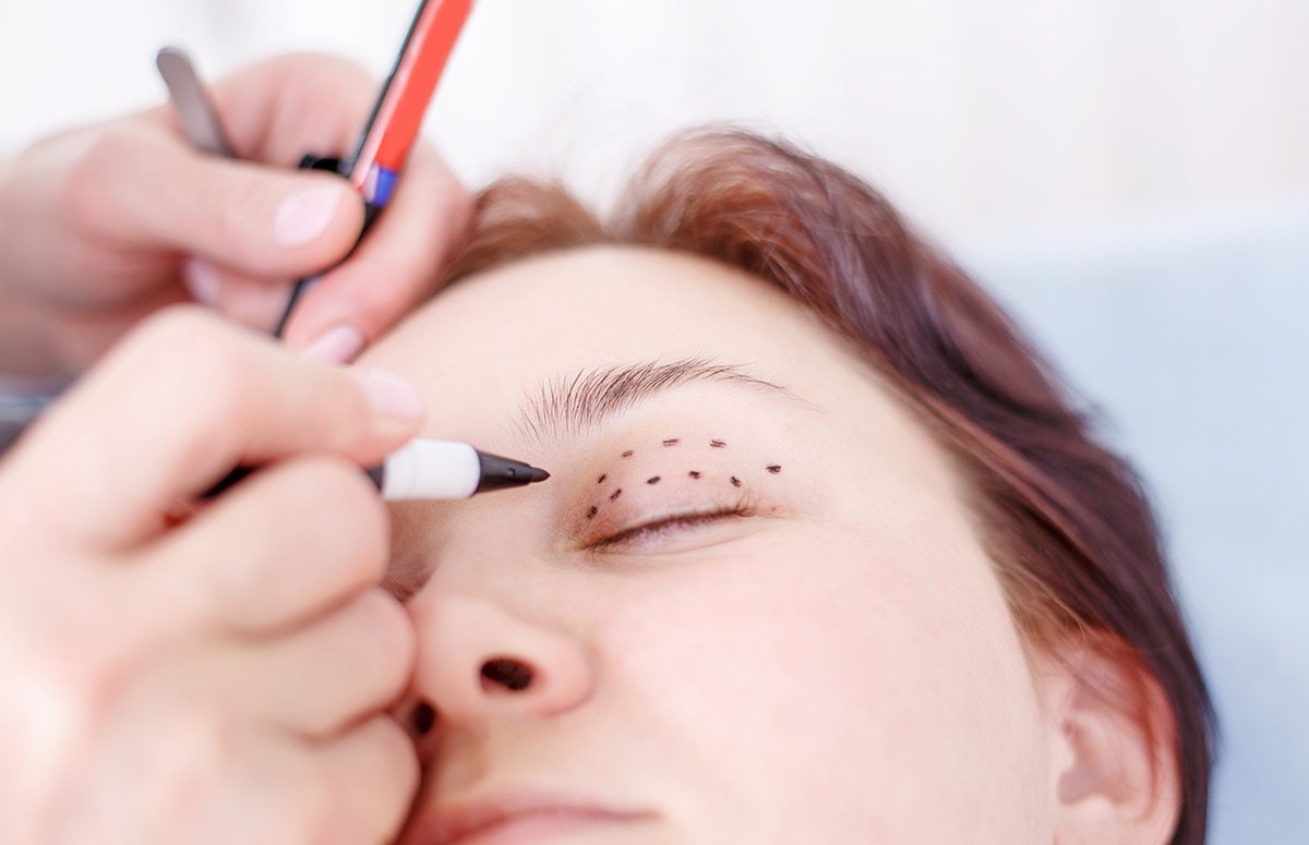 Blepharoplasty Services Ohio Eye Closeup with Sketch marks