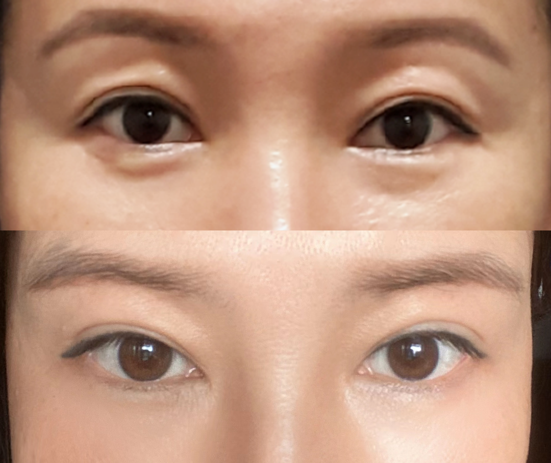 NU SKIN Lumispa眼部全面护理导头使用效果对比&净肤露Q&A！ – ZcLive