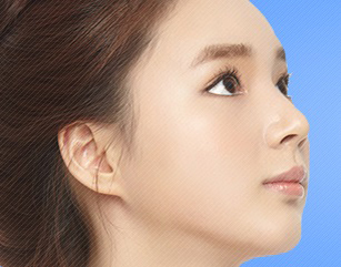 Protruding Chin Surgery In Korea
