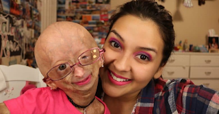 Adalia Rose Net Worth, Income, Salary, Earnings, Biography, How much money make?