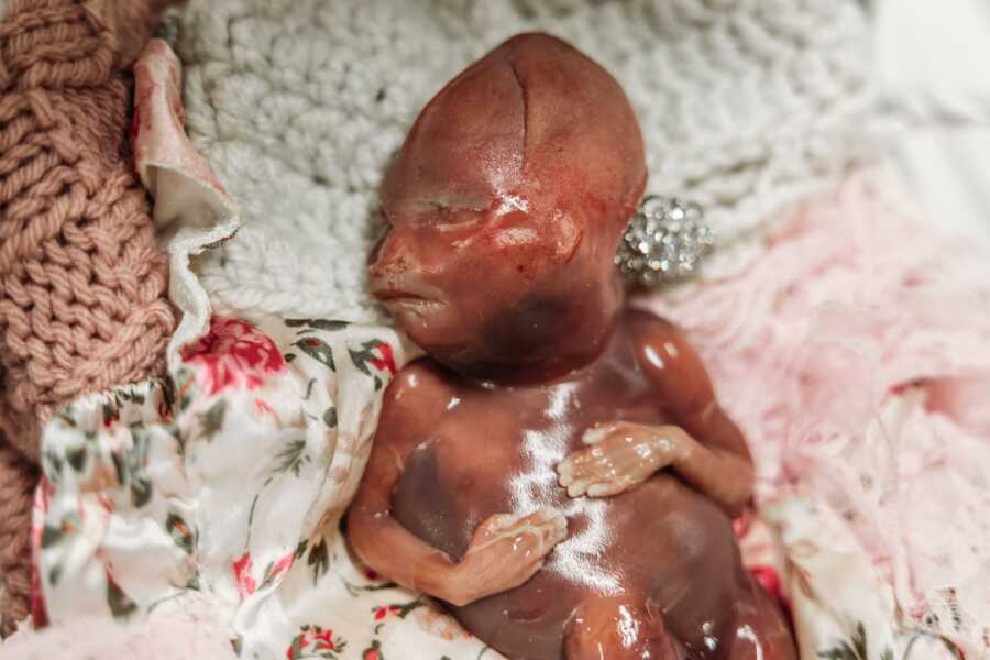 ‘I NEEDED this for my grieving process. It was the most incredible thing I’ve ever witnessed.’: Grieving mom uses saline bath to capture beautiful pictures of miscarried baby (1) ‘I NEEDED this for my grieving process. It was the most incredible thing I’ve ever witnessed.’: Grieving mom uses saline bath to capture beautiful pictures of miscarried baby (1)