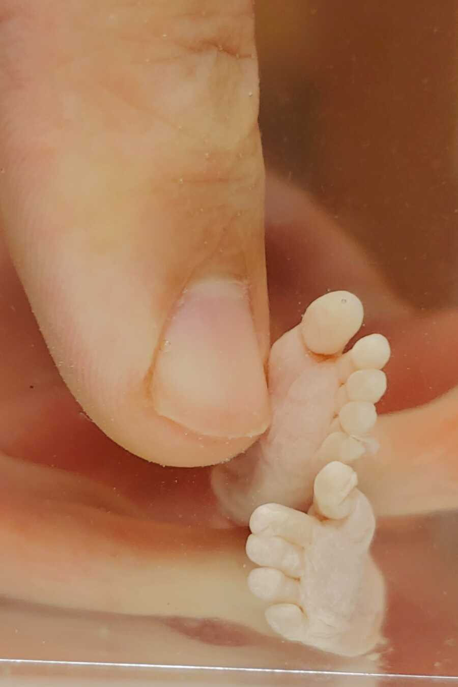 ‘I NEEDED this for my grieving process. It was the most incredible thing I’ve ever witnessed.’: Grieving mom uses saline bath to capture beautiful pictures of miscarried baby (8) ‘I NEEDED this for my grieving process. It was the most incredible thing I’ve ever witnessed.’: Grieving mom uses saline bath to capture beautiful pictures of miscarried baby (8)