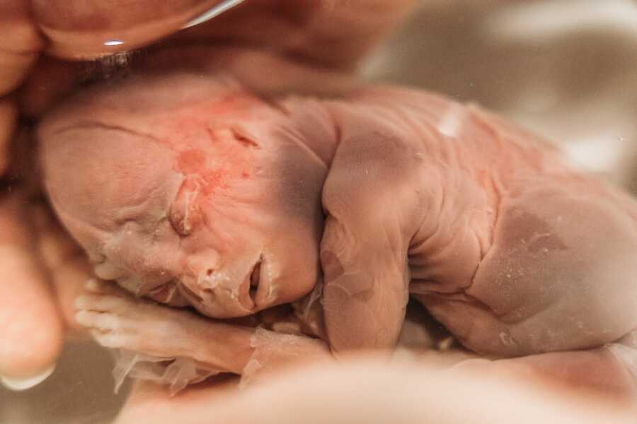 ‘I NEEDED this for my grieving process. It was the most incredible thing I’ve ever witnessed.’: Grieving mom uses saline bath to capture beautiful pictures of miscarried baby (3) ‘I NEEDED this for my grieving process. It was the most incredible thing I’ve ever witnessed.’: Grieving mom uses saline bath to capture beautiful pictures of miscarried baby (3)