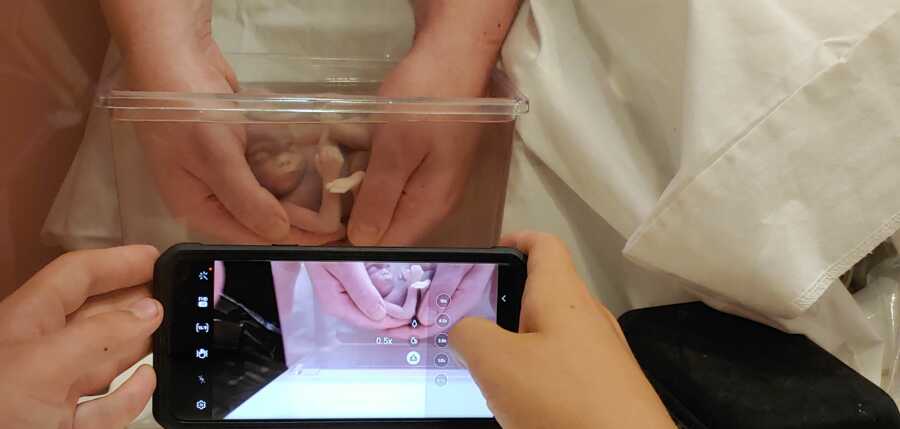 ‘I NEEDED this for my grieving process. It was the most incredible thing I’ve ever witnessed.’: Grieving mom uses saline bath to capture beautiful pictures of miscarried baby (6) ‘I NEEDED this for my grieving process. It was the most incredible thing I’ve ever witnessed.’: Grieving mom uses saline bath to capture beautiful pictures of miscarried baby (6)
