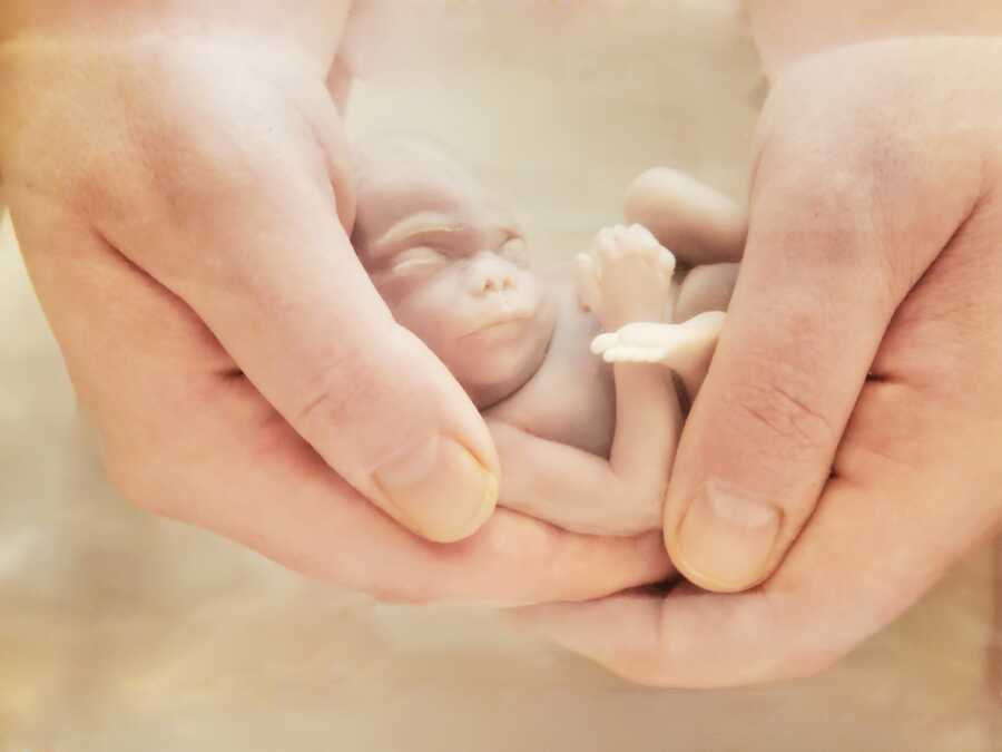 ‘I NEEDED this for my grieving process. It was the most incredible thing I’ve ever witnessed.’: Grieving mom uses saline bath to capture beautiful pictures of miscarried baby (7) ‘I NEEDED this for my grieving process. It was the most incredible thing I’ve ever witnessed.’: Grieving mom uses saline bath to capture beautiful pictures of miscarried baby (7)
