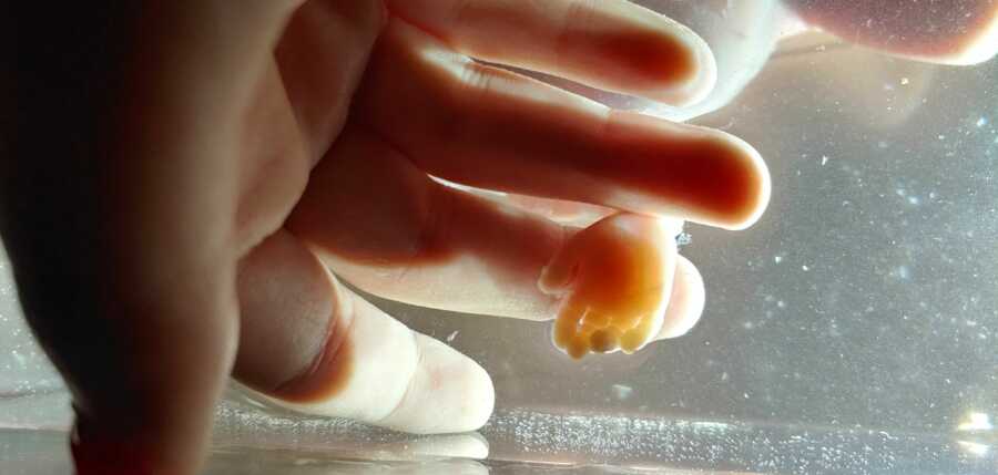 ‘I NEEDED this for my grieving process. It was the most incredible thing I’ve ever witnessed.’: Grieving mom uses saline bath to capture beautiful pictures of miscarried baby (9) ‘I NEEDED this for my grieving process. It was the most incredible thing I’ve ever witnessed.’: Grieving mom uses saline bath to capture beautiful pictures of miscarried baby (9)