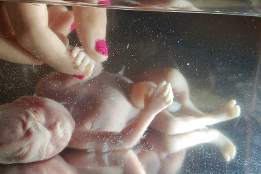 ‘I NEEDED this for my grieving process. It was the most incredible thing I’ve ever witnessed.’: Grieving mom uses saline bath to capture beautiful pictures of miscarried baby (5) ‘I NEEDED this for my grieving process. It was the most incredible thing I’ve ever witnessed.’: Grieving mom uses saline bath to capture beautiful pictures of miscarried baby (5)