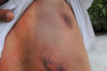 ¡INSÓLITO! Militantes de UNT en Maracaibo agredieron a periodista que grababa trifulca y lo obligaron a borrar fotos