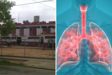 ¡GRAVE! Falleció cuarto reo por tuberculosis en el retén de Cabimas