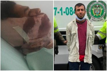 ¡HASTA CUÁNDO! “¿Qué hacen aquí? Esto es Colombia”: pareja de venezolanos fue atacada a cuchillos por vender y rebuscarse la vida en las calles de Bogotá (+Dramático relato)