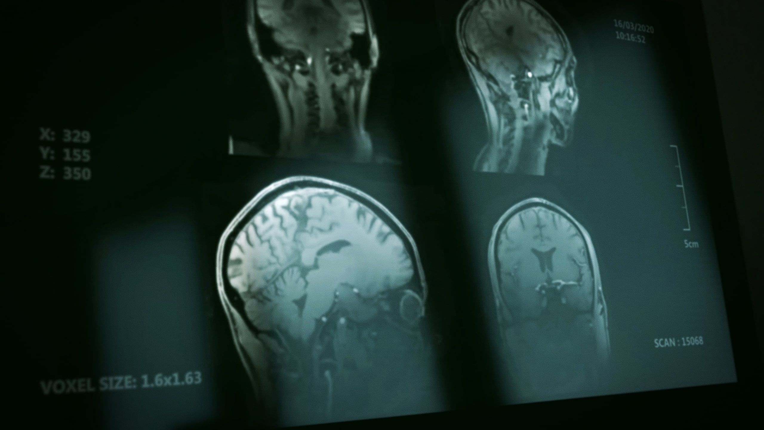 X-Rays showing a human head and brain