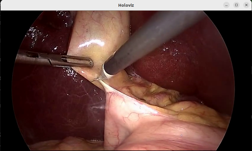 Video Streaming Demo