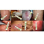Psoriasis Eczema Ointment Dermatitis Vitiligo Skin Rash Cream thumbnail
