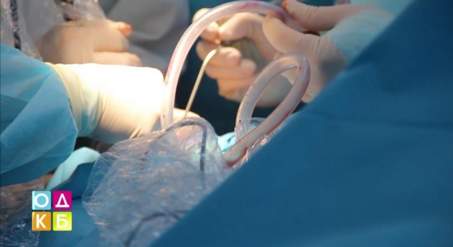 В Кузбассе медики медики спасли младенца с разрывом кисты в головном мозге