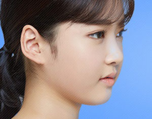 facial asymmetry surgery korea