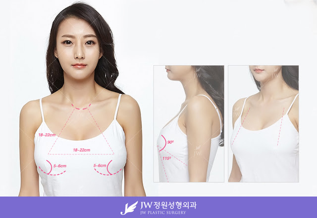 Breast Surgery in Seoul