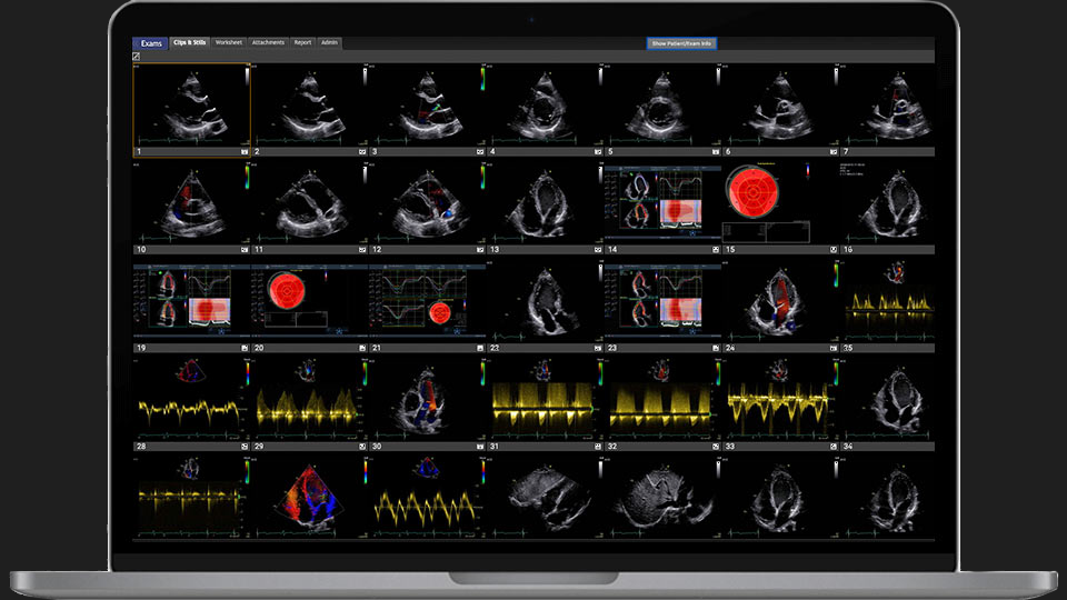 Medical imaging viewer depicting a group of medical images with a dark background