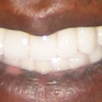 Cosmetic Dentistry: After Image