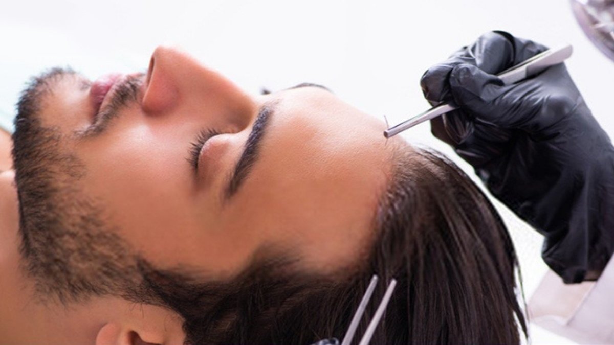Affordable and Advanced FUE Hair Transplant treatments with promising results-Digpu