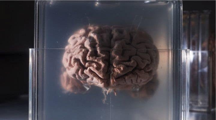 Preserve and digitize the brain nectome