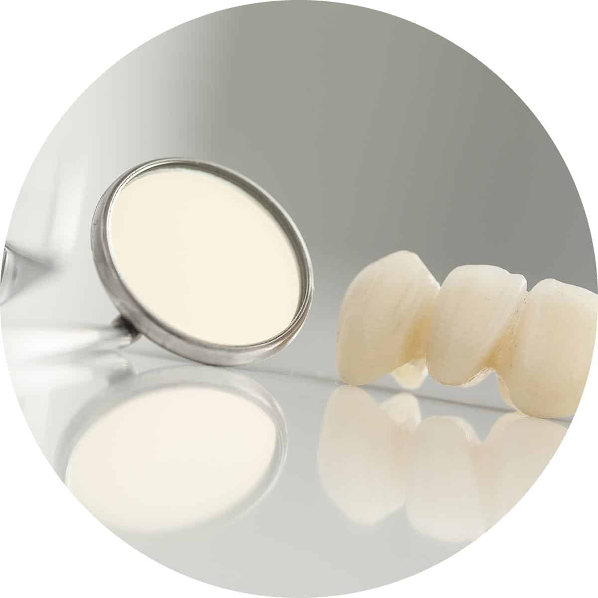 Crowns and Bridges Dental Treatment