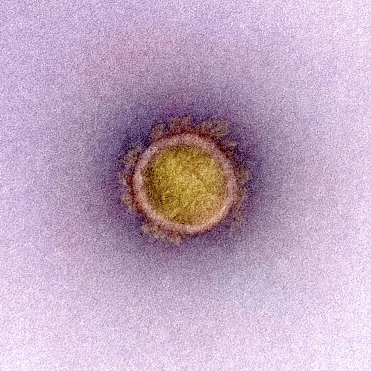 Imagen detallada de un coronavirus 