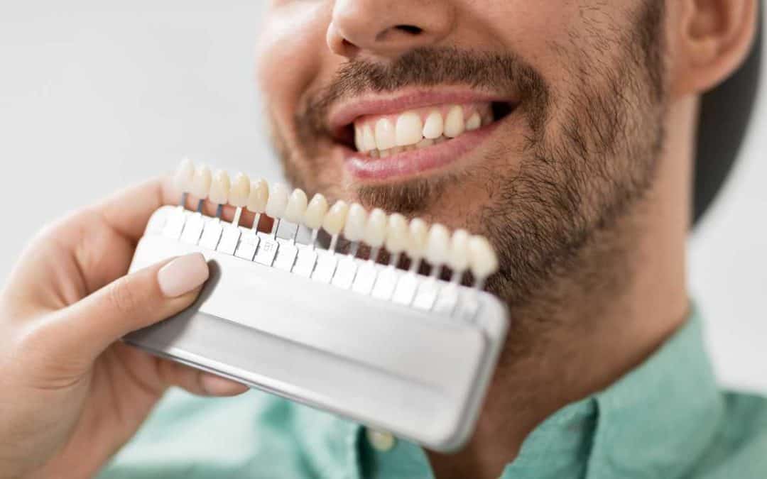 pros and cons of dental veneers