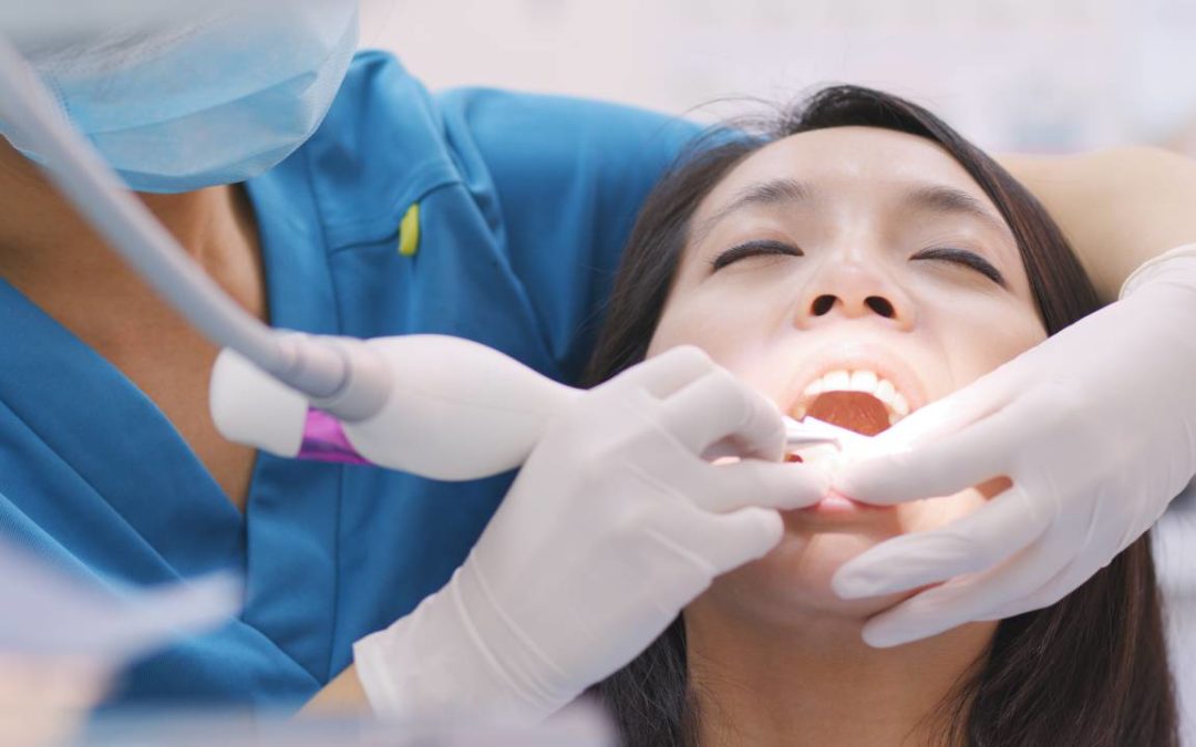 The Benefits Of Deep Teeth Cleaning