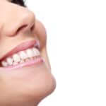 Unveiling a Brighter Smile: Understanding Teeth Whitening