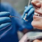 what is considered major dental care