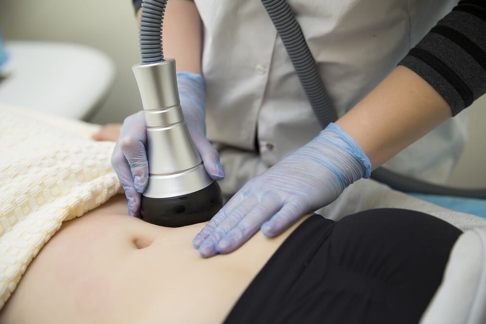 What is Laser Lipo and does it work?