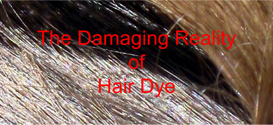 The Damaging Reality of Allergic Reactions To Hair Dye