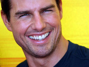 Tom Cruise - dental veneers