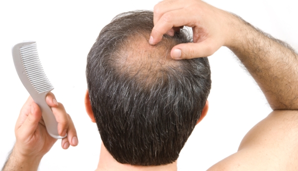 Man with comb worrying about hair loss